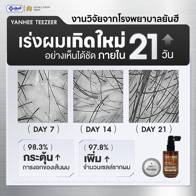 YANHEE TEEZEER SERUM ยันฮี ทีเซอร์ เซรั่ม บำรุง ผมแข็งแรง เพิ่มการงอกใหม่ หัวล้าน ผมบาง ผมหงอก ร่วง รูปที่ 8