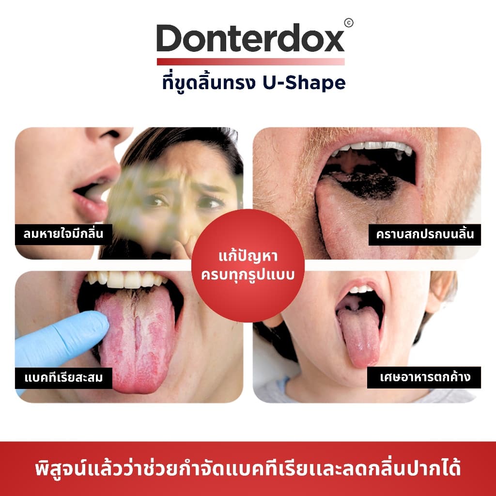 Donterdox - ที่ขูดลิ้นสแตนเลสทรง U-Shape แปรงทำความสะอาดลิ้น ขจัดกลิ่นปาก ทำความสะอาดอย่างทั่วถึง รูปที่ 5