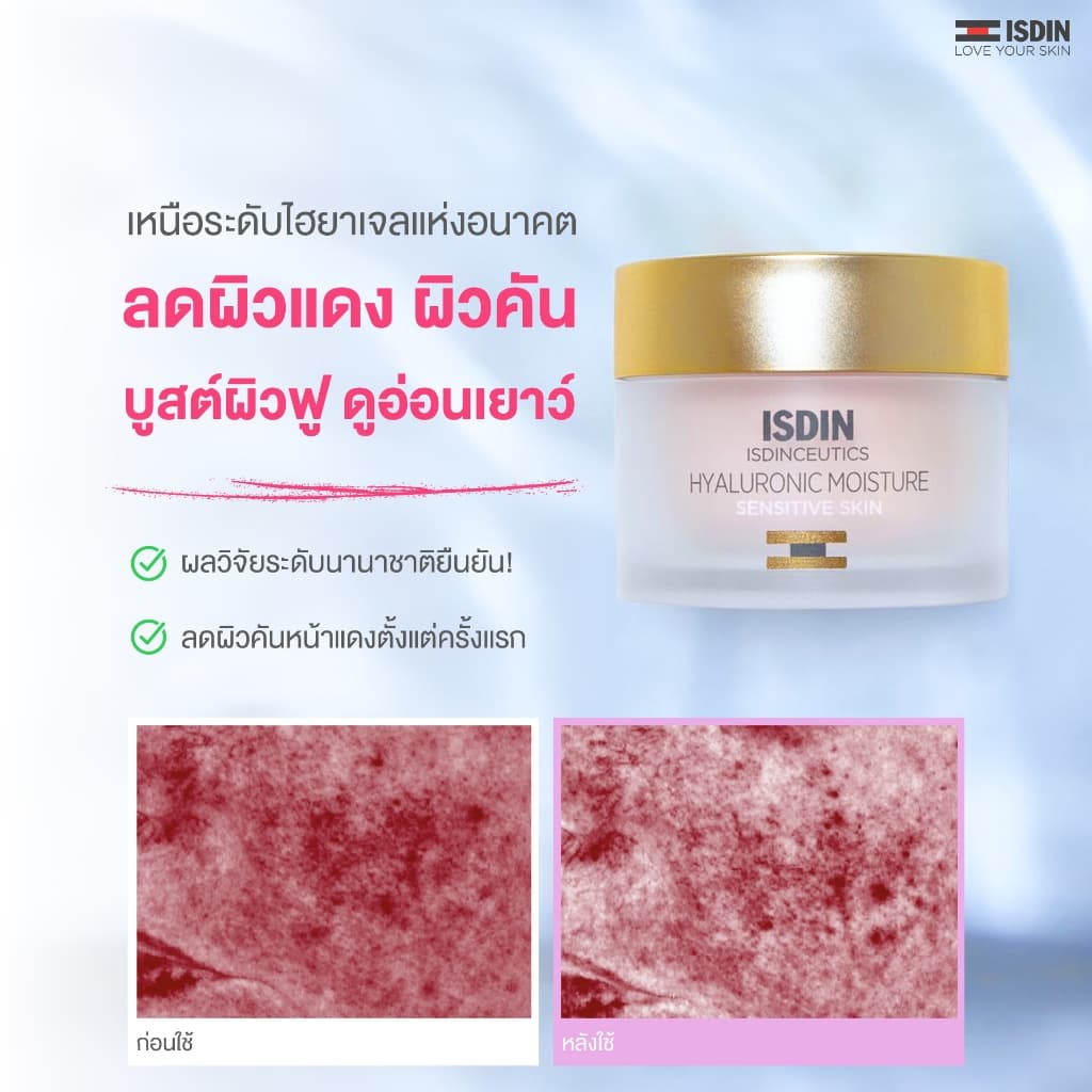 HYALURONIC MOISTURE SENSITIVE เจลครีมลดผิวแดง หน้าแสบตั้งแต่ครั้งแรกที่ใช้ พร้อมดูแล 7 สัญญาณผิวเสียแห่งวัย รูปที่ 2