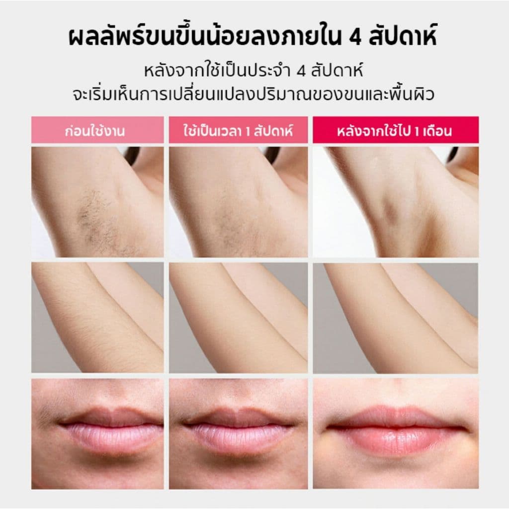 ORRO IPL Gen3 เครื่องกำจัดขน & หน้าใส เลเซอร์กำจัดขน Multi Function สี Black Gold รูปที่ 8