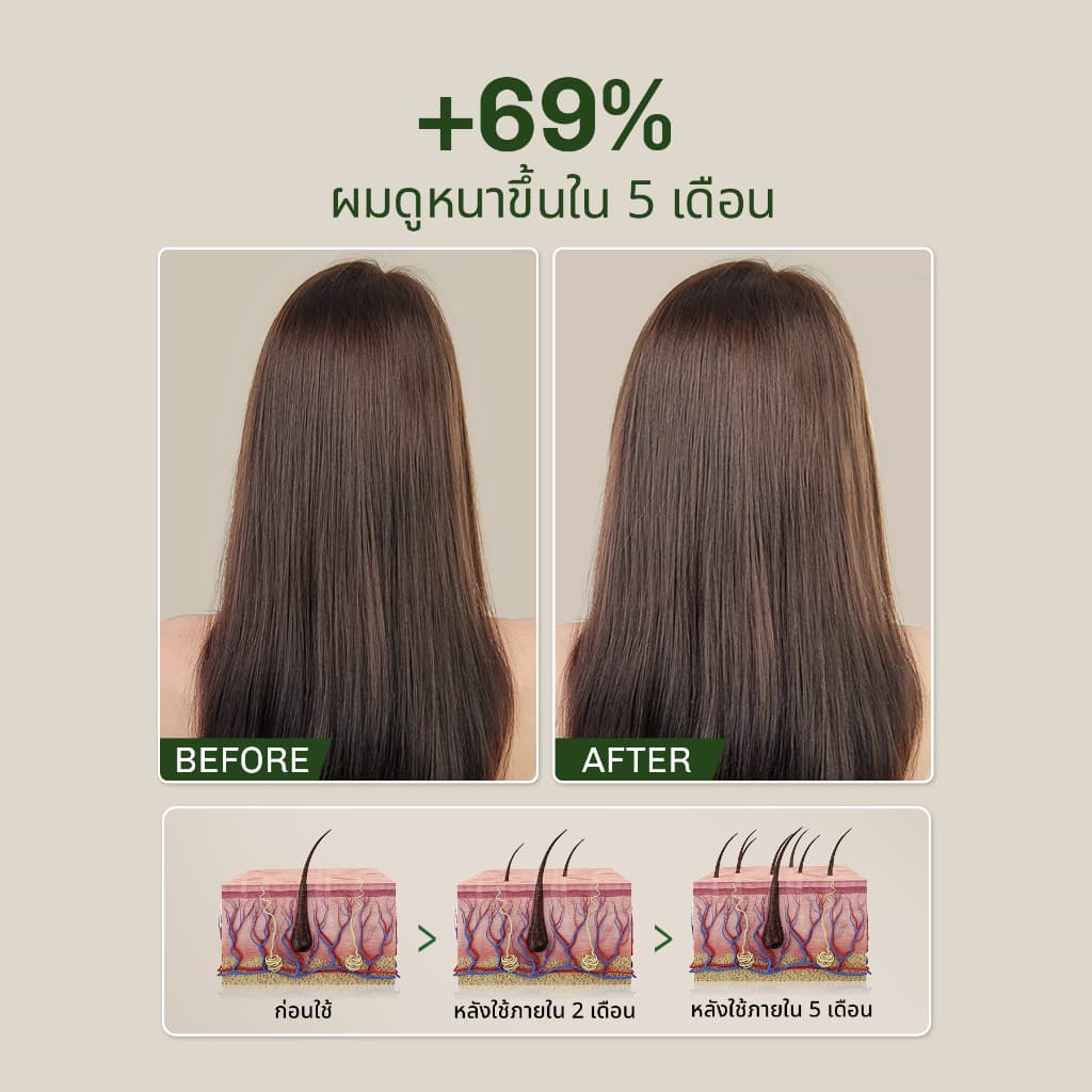 lavojoy SET Hold me tight Pro Shampoo Spring Wonder + Conditioner Spring Wonder เซตคู่แชมพู+ครีมนวมผม ลดผมร่วง รูปที่ 5