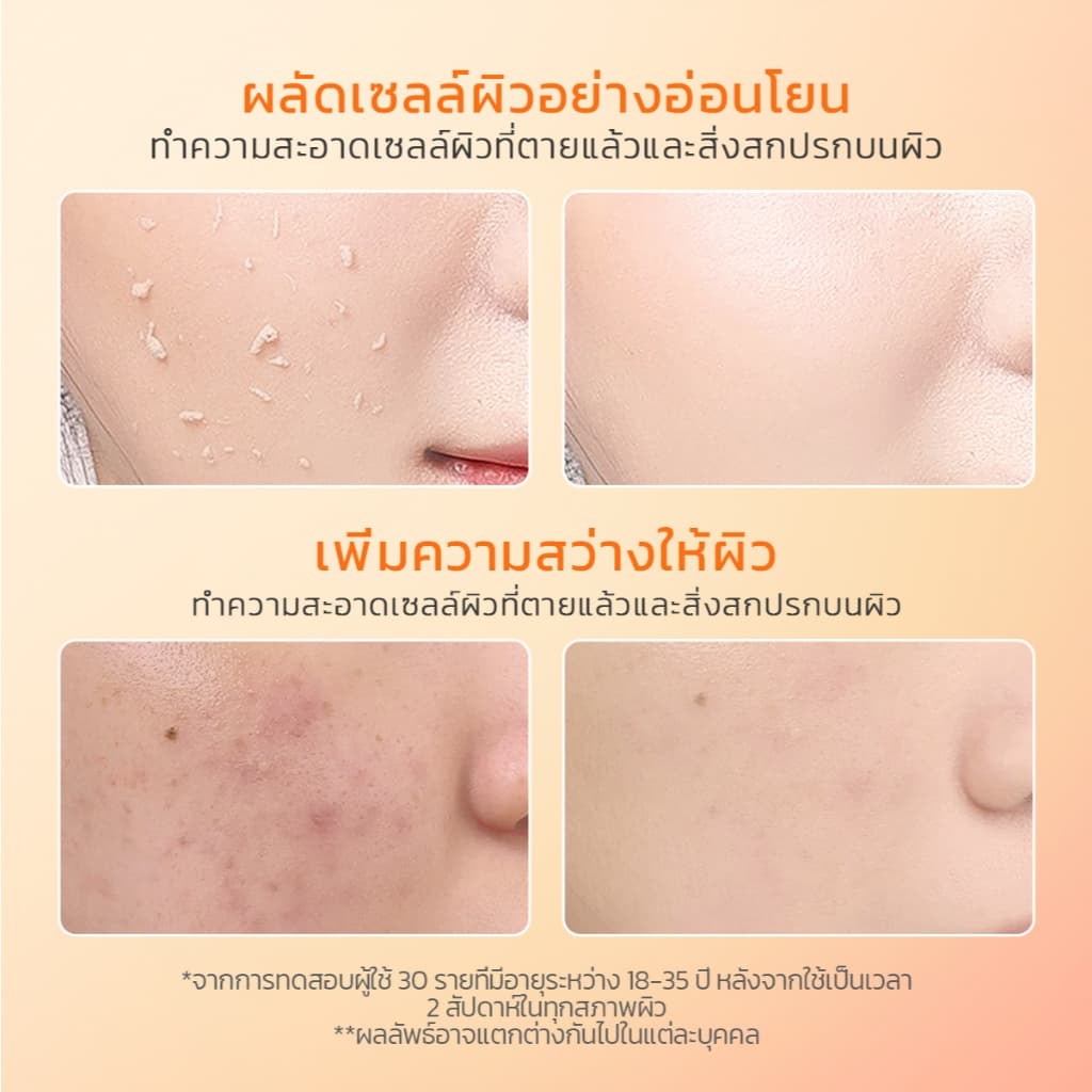 Glad2Glow Apricot Glycolic Acid Exfo Smooth Peeling Gel เจลผลัดเซลล์ผิว Cleansing รูปที่ 2