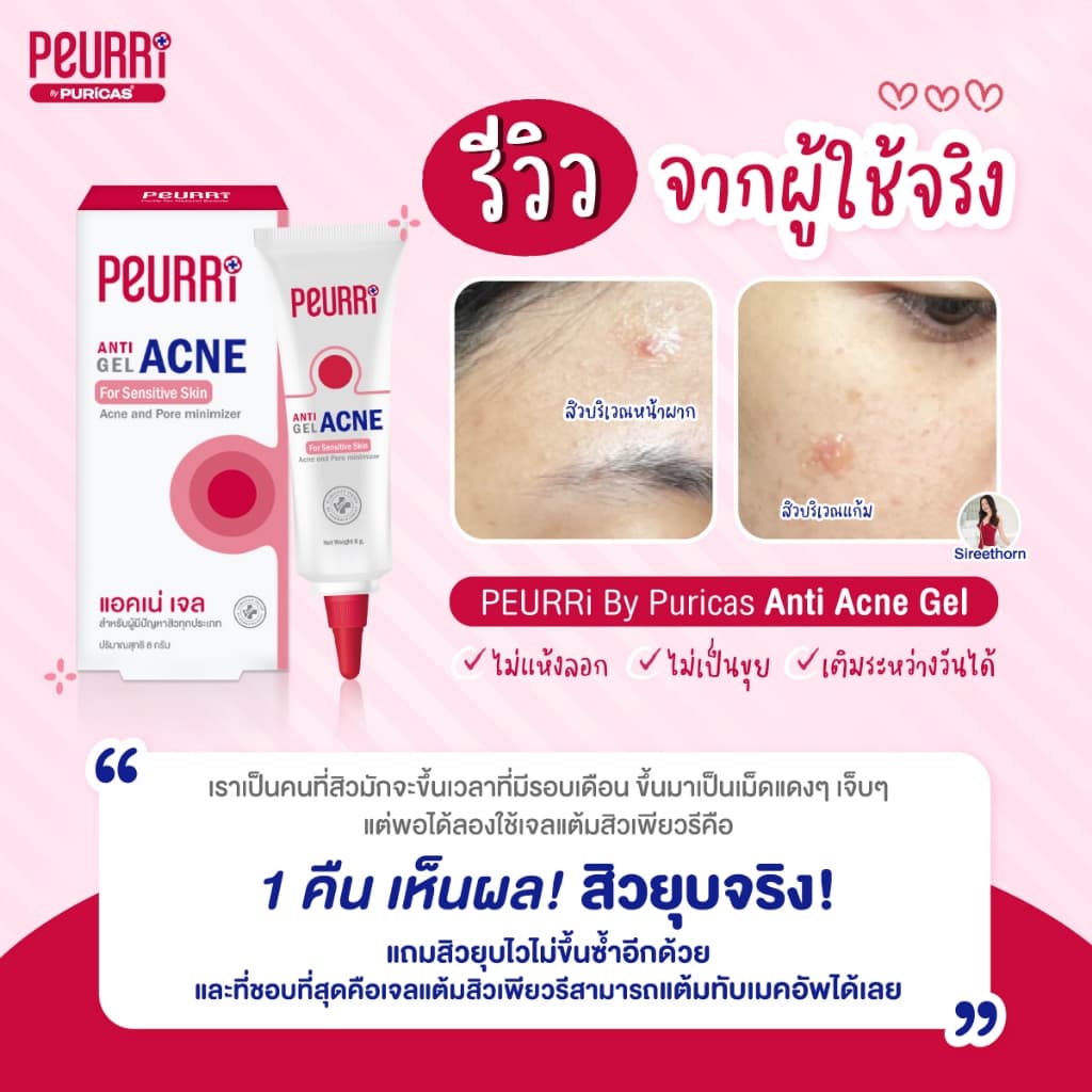 PEURRi Anti Gel Acne เจลแต้มสิว 8 g. รูปที่ 5