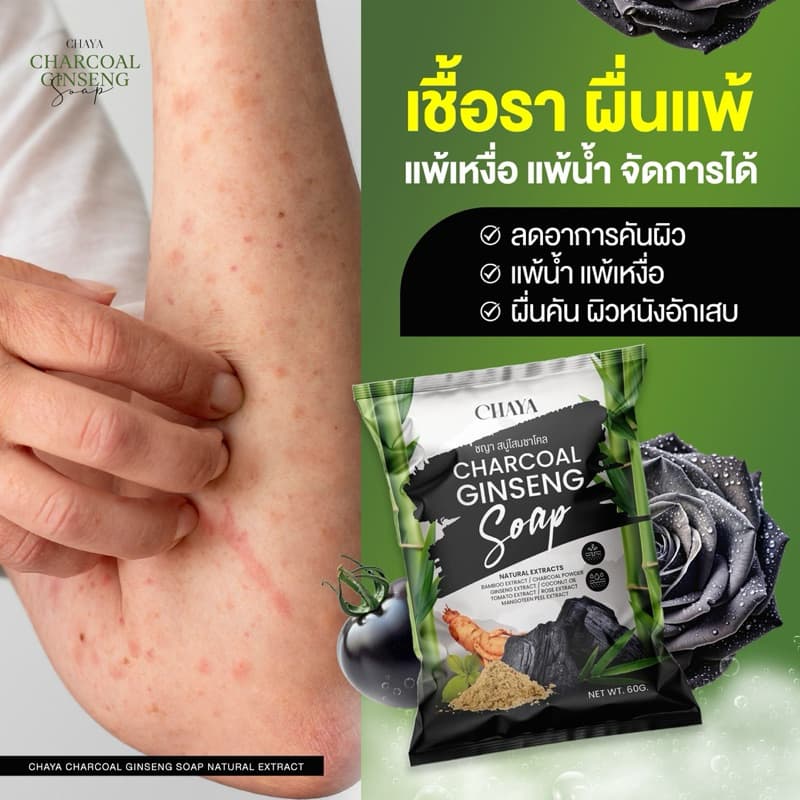สบู่โสมชาโคล ดีท็อกซ์ผิว แก้คัน ลดสิว By.ชญา รูปที่ 1