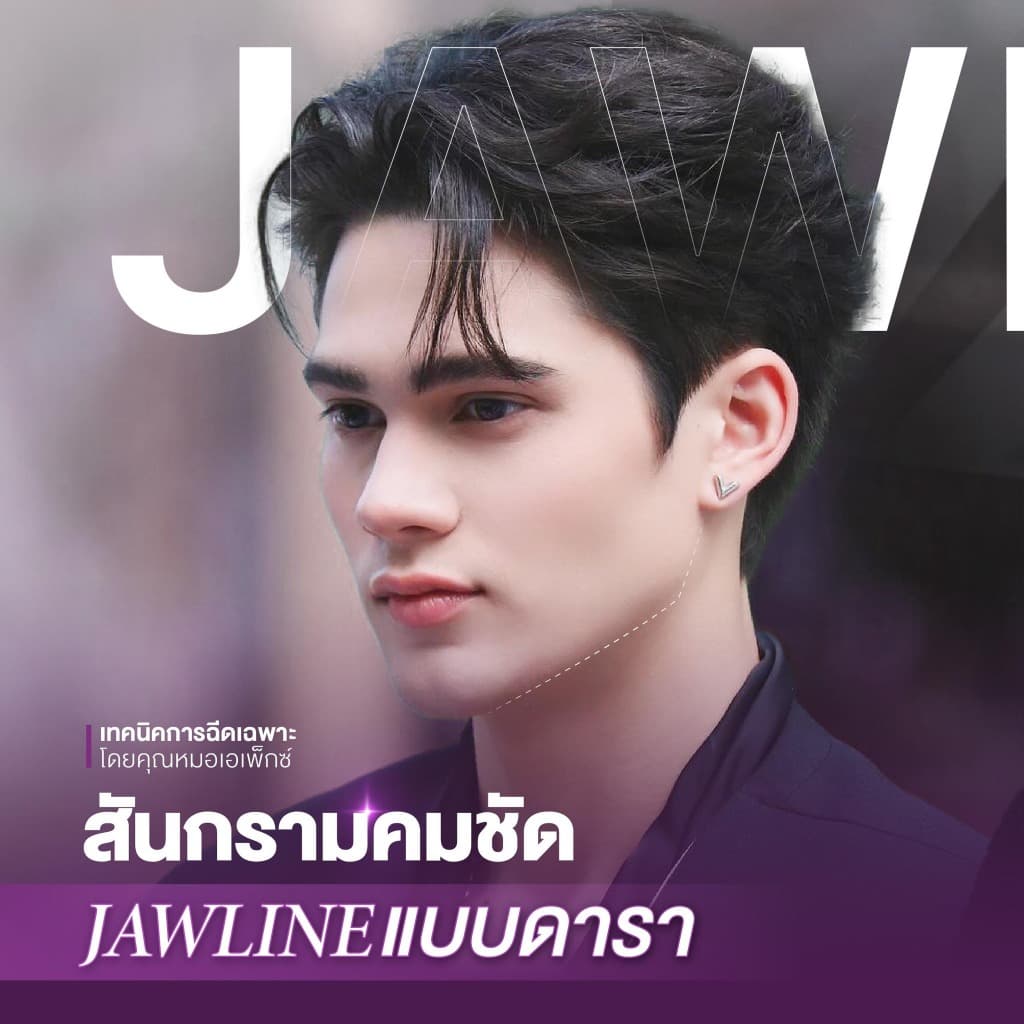 APEX โปรแกรมBo โบท็อกซ์ ลดกราม ลดริ้วรอย ลิฟต์กรอบหน้า 50U + ultraformer หน้าเรียว X2 รูปที่ 6