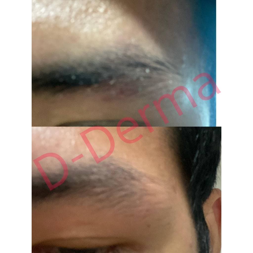 เซรั่ม D-Derma เซ็บเดิร์ม ผิวแห้ง ลอก คัน แดง ผิวแข็งแรง แพ้ ผิวหนังอักเสบ ผดผื่น ชุ่มชื่น รูปที่ 5