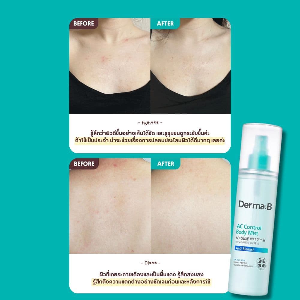 Derma: B AC Control Body Mist 200ml รูปที่ 3
