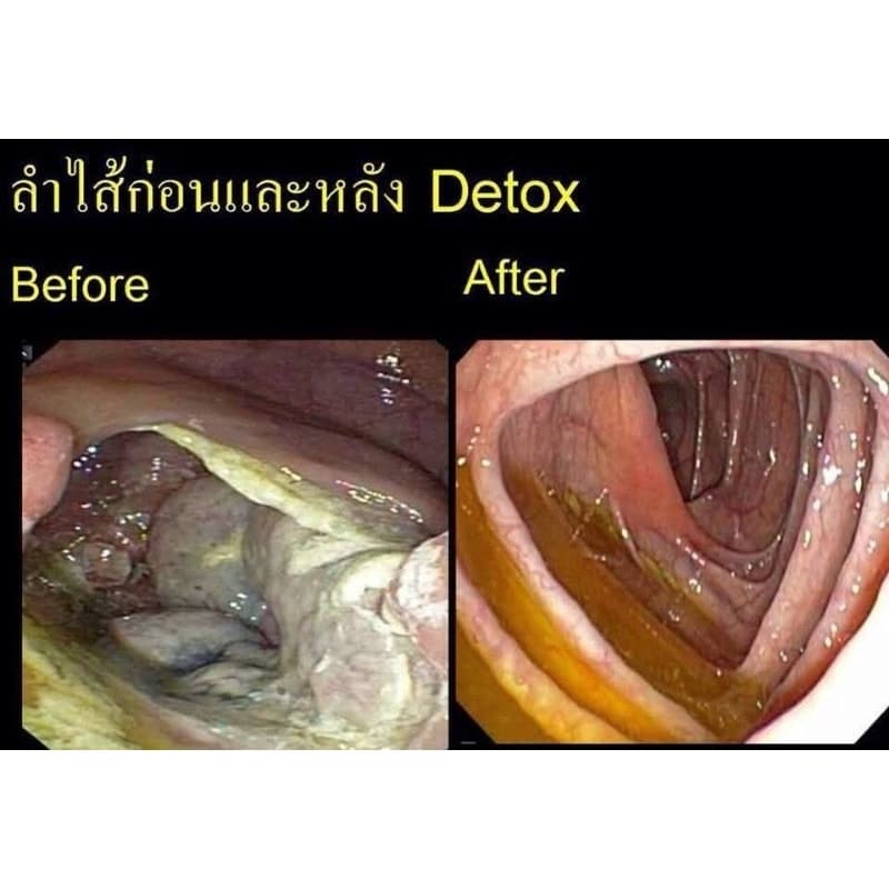 ไฟโตวีPHYTOVY ดีทอกซ์ธรรมชาติ 15ซอง รูปที่ 9