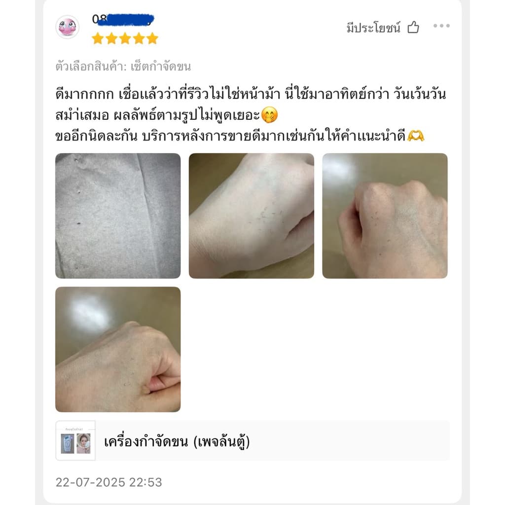 เครื่องกำจัดขน รุ่นใหม่สีดำ รูปที่ 6
