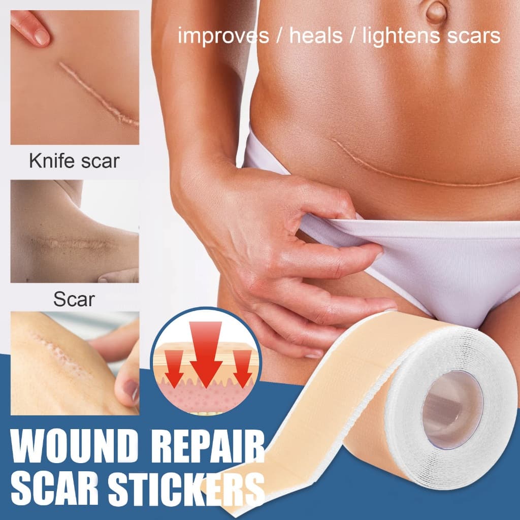 South Moon silicone scar sheet รักษารอยแผลเป็น แผ่นแปะแผลเป็น กําจัดรอยแผลเป็นจากแผลเป็น เผยผิวเนียนสวย รูปที่ 6