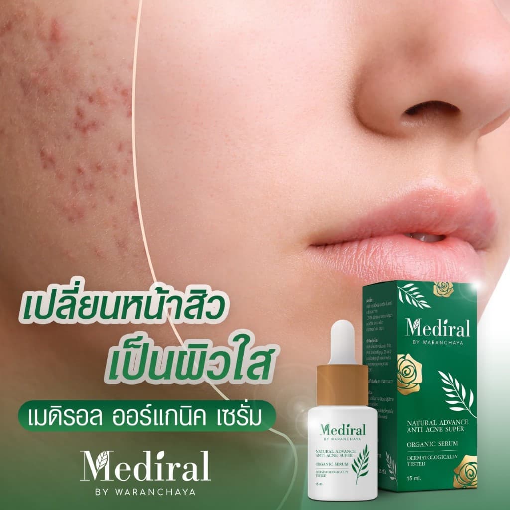 เมดิรอล เซรั่มลดสิวMediral ตัดวงจรสิวซ้ำซาก ฆ่าเชื้อสิวใน7วันดีขึ้น ผิวแข็งแรง ออร์แกนิก รูปที่ 3