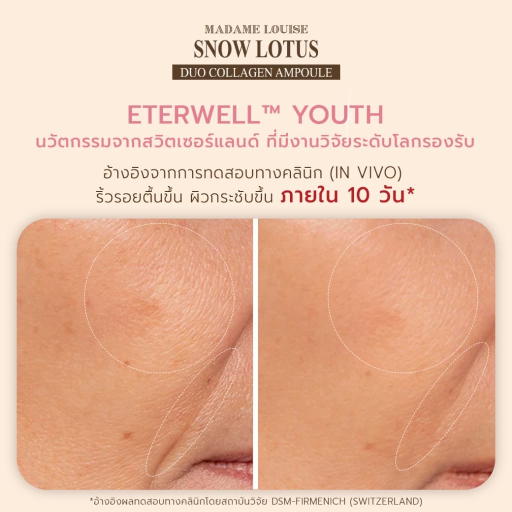 Madame Louise แอมพูลบัวหิมะ PDRN Exosome Duo Collagen Ampoule เซตคู่ Day & Night กู้ผิวโทรม หน้าฟู ผิวกระจก รูปที่ 6
