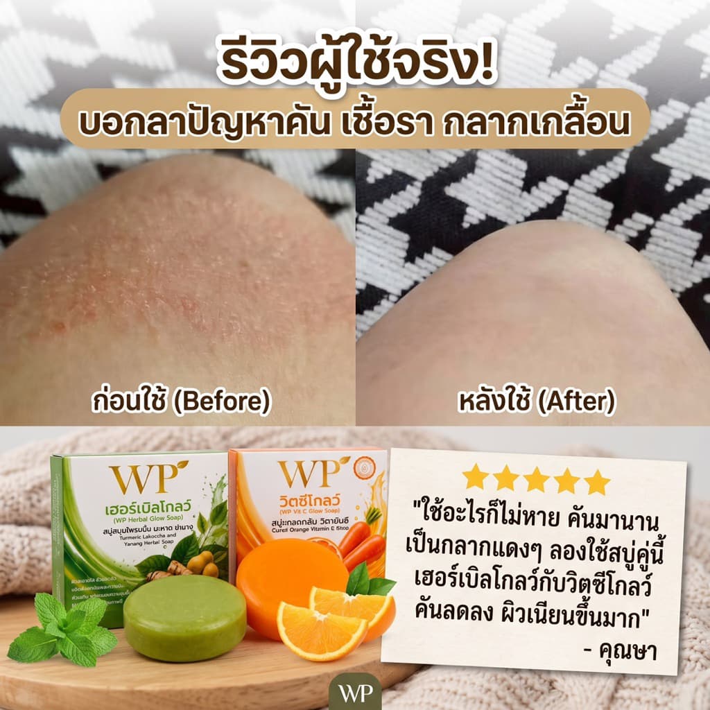 สบู่WPเฮอร์เบิลโกลว์ ใช้ได้ทั้งผิวหน้าและผิวกาย สมุนไพรออแกนิก 100% หยุดคัน หยุดเกา รูปที่ 4