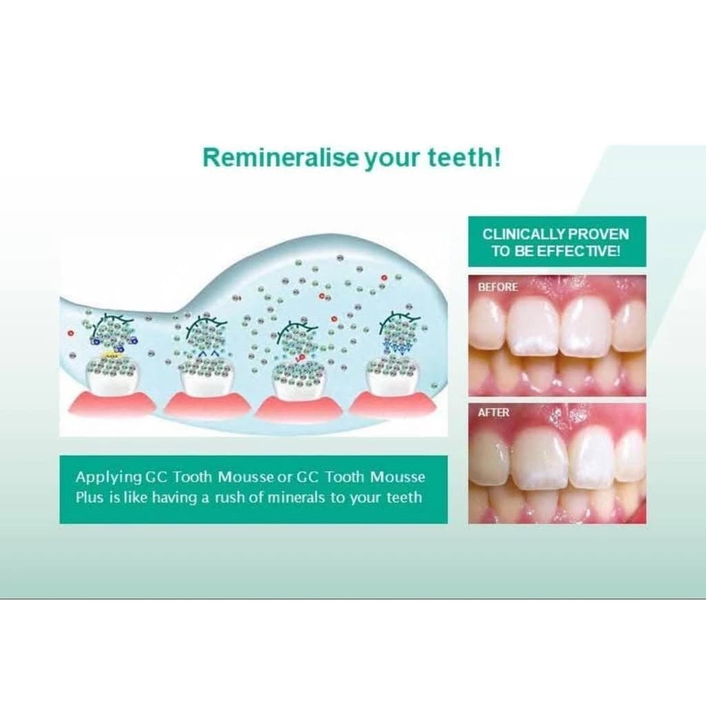 GC Tooth Mousse Plus Strawberry ผสมฟลูออไรด์ รูปที่ 3