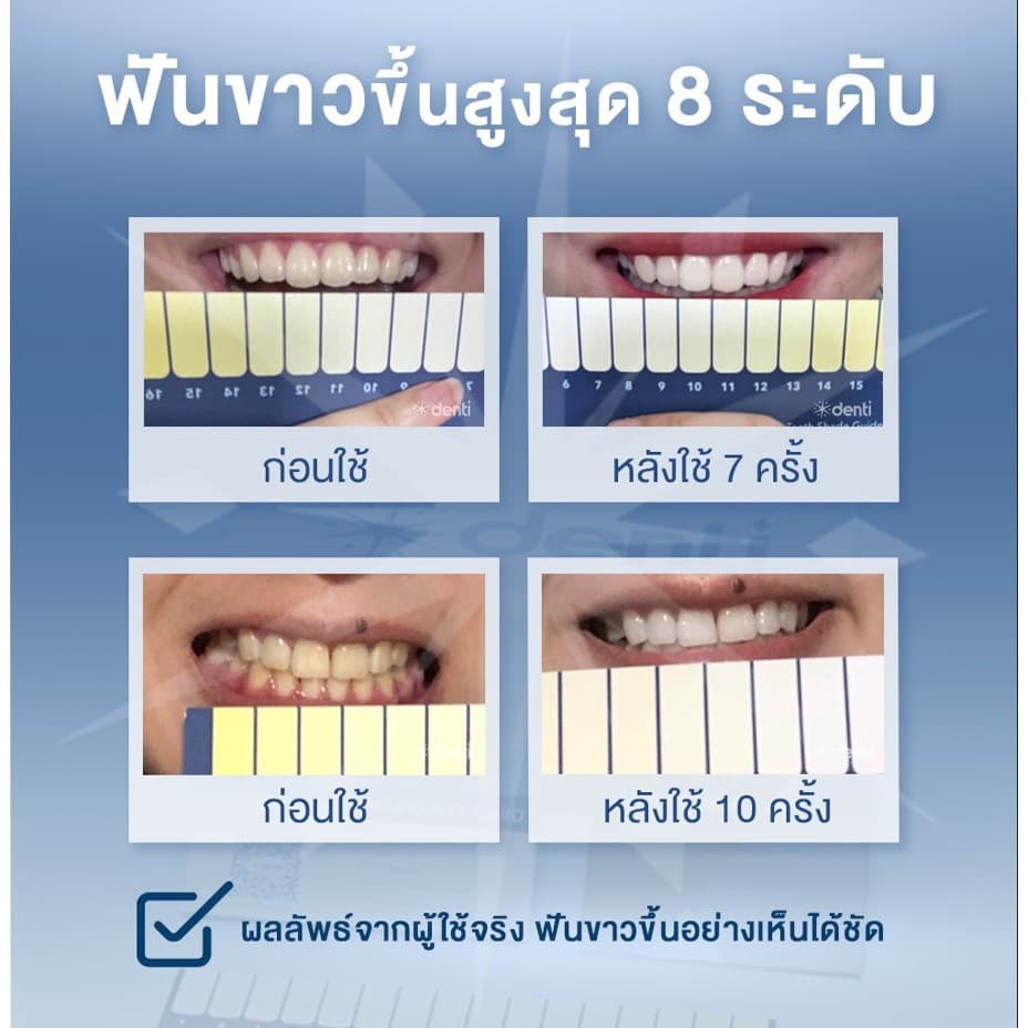 ฟอกฟันขาว ฟันขาว น้ำยาฟอกฟันขาว ที่ฟอกฟันขาว ยาฟอกฟันขาว น้ำยาขัดฟันขาวTeeth Whitening Pen ปากกาฟอกฟันขาว เจลฟอกฟันขาว รูปที่ 4