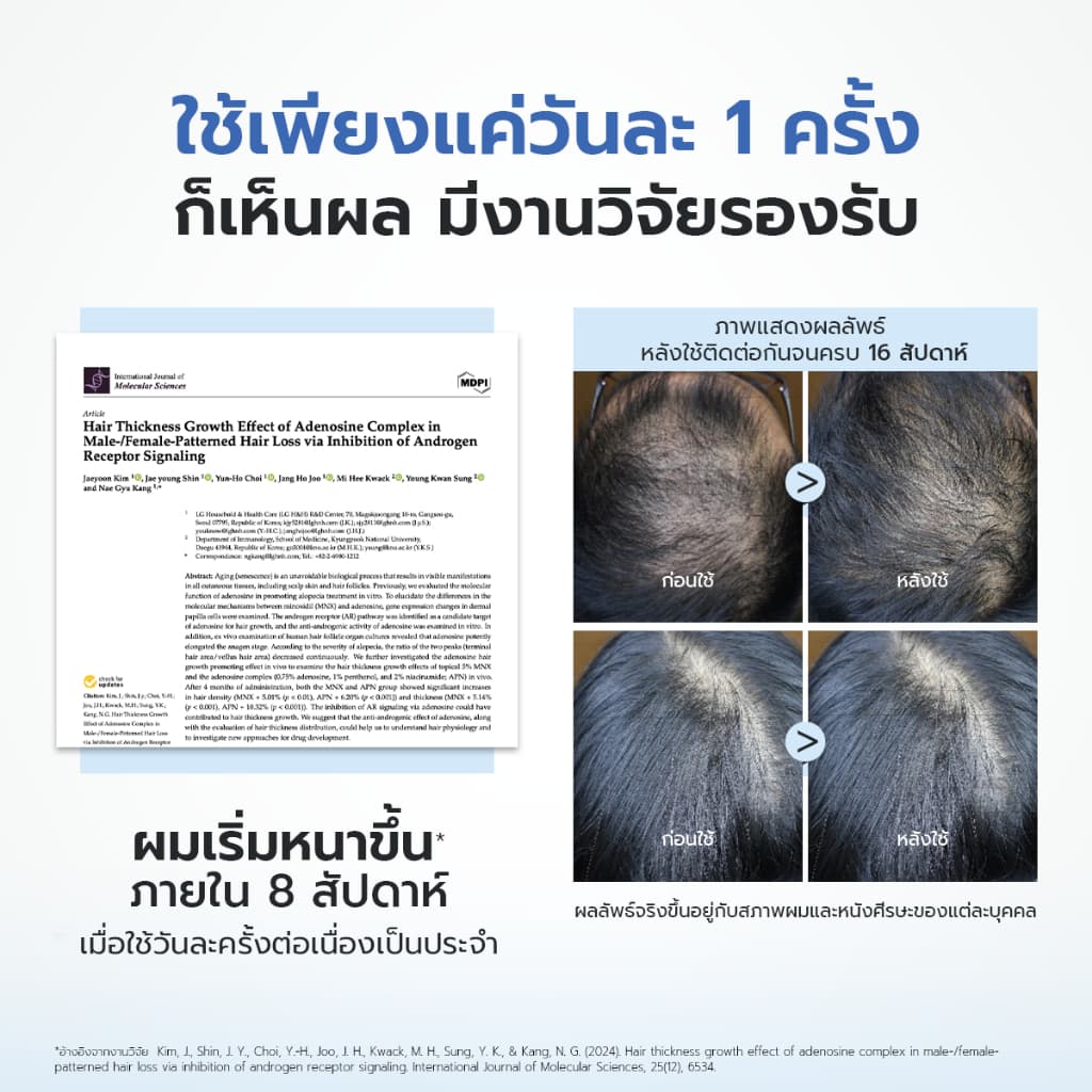 KEBOU 8X DEFENSE HAIR SCALP SERUM เวชสำอางลดผมขาดหลุดร่วง ลดรังแคและอาการคันในขั้นตอนเดียว รูปที่ 7