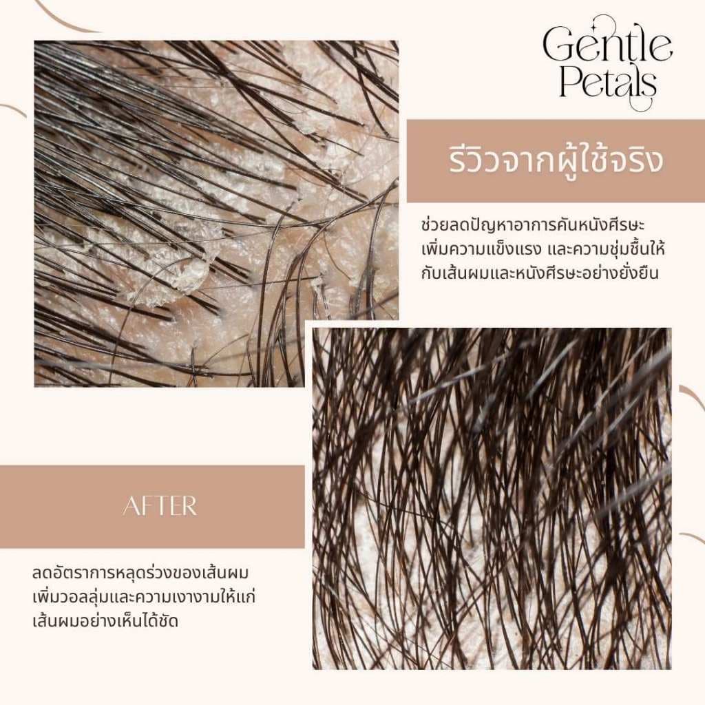 ทรีทเมนท์บำรุงผม เพียงหมักแล้วสระ ลดผมร่วง ทรีทเม้นท์บำรุงผม น้ำมันละหุ่ง ออยล์บำรุงผม ลดรังแค รูปที่ 3