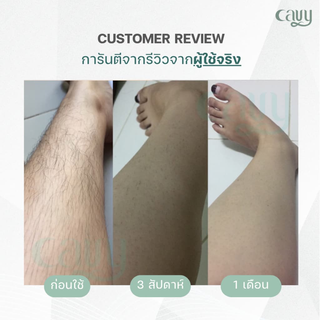 CAVY PLUS IPL 3in1 เครื่องเลเซอร์กำจัดขน หน้าใส ลดสิว 3 ฟังก์ชัน พร้อมโหมดเย็น - ประกัน1ปี รูปที่ 7
