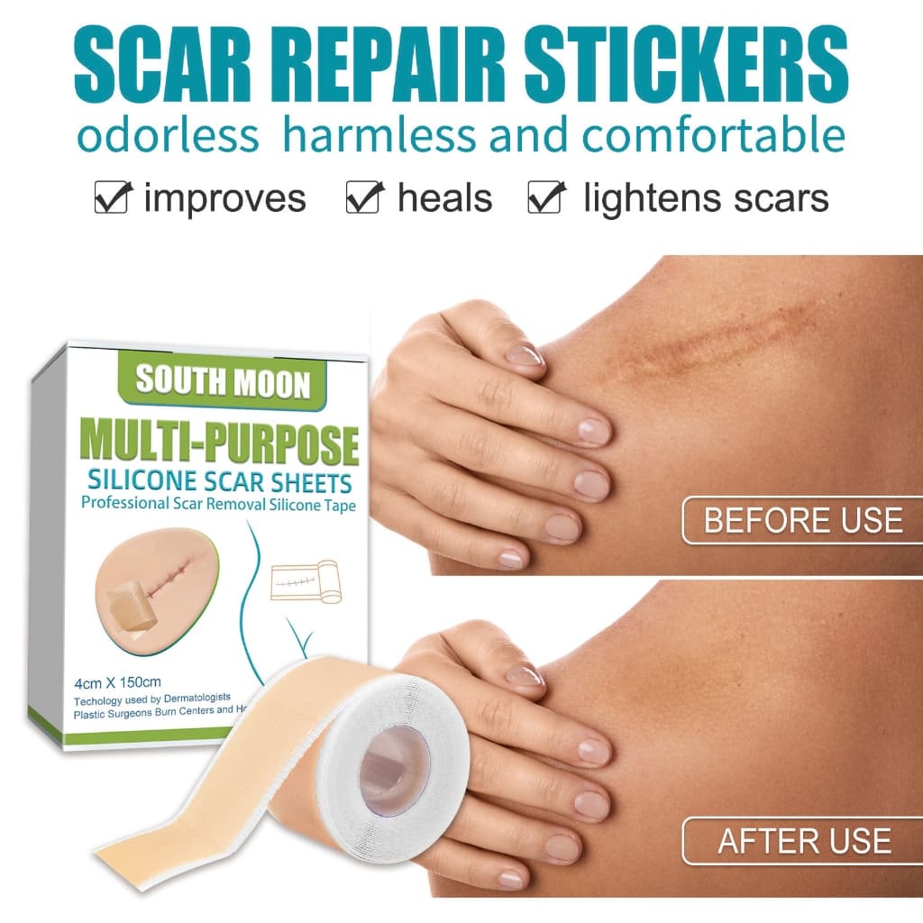 South Moon silicone scar sheet รักษารอยแผลเป็น แผ่นแปะแผลเป็น กําจัดรอยแผลเป็นจากแผลเป็น เผยผิวเนียนสวย รูปที่ 2