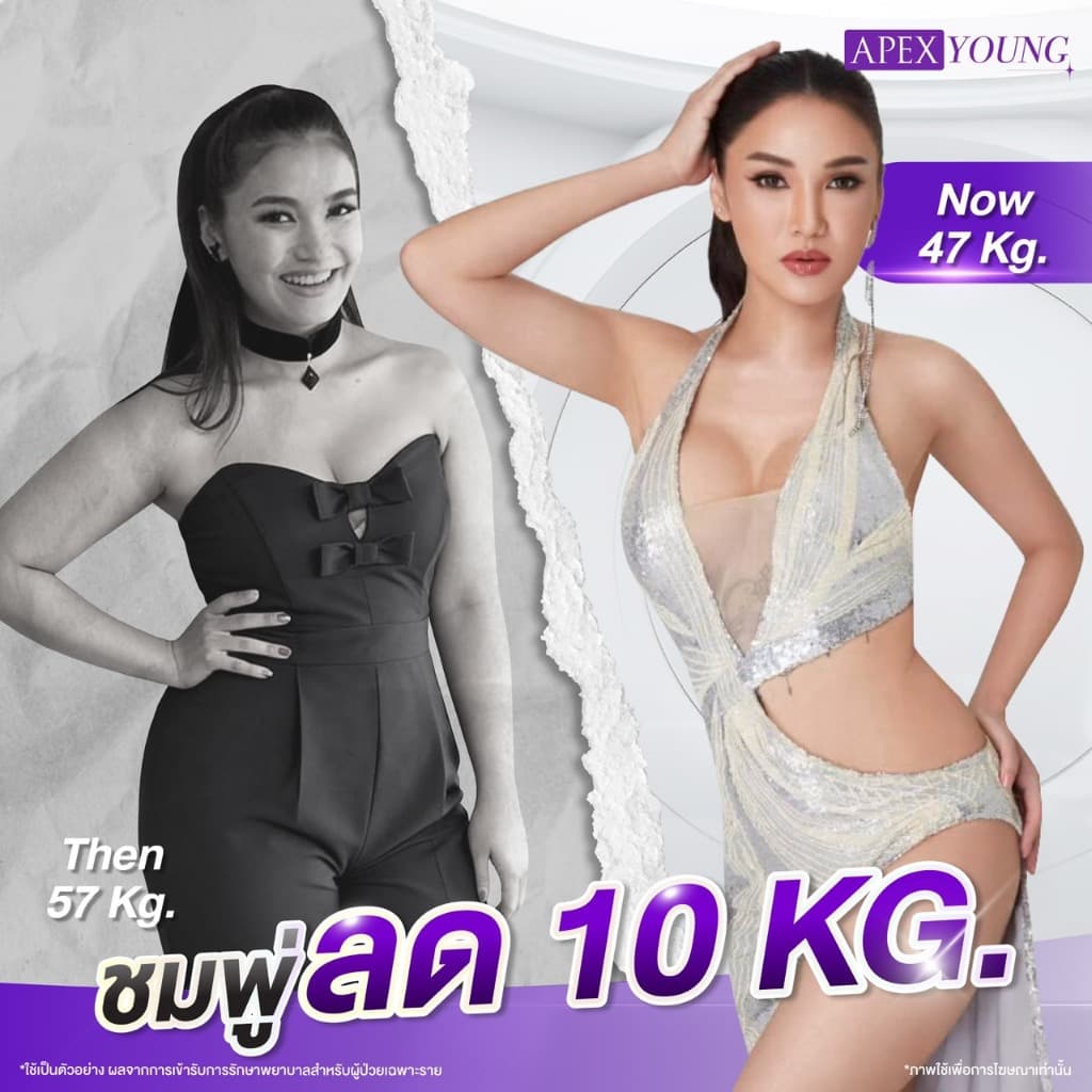 APEX โปรแกรมเร่งเผาพลาญ 1 Week 1 Kilo ปากกาลดได้ทุกวีค ควบคุมน้ำหนักโดยแพทย์ APEX รูปที่ 4