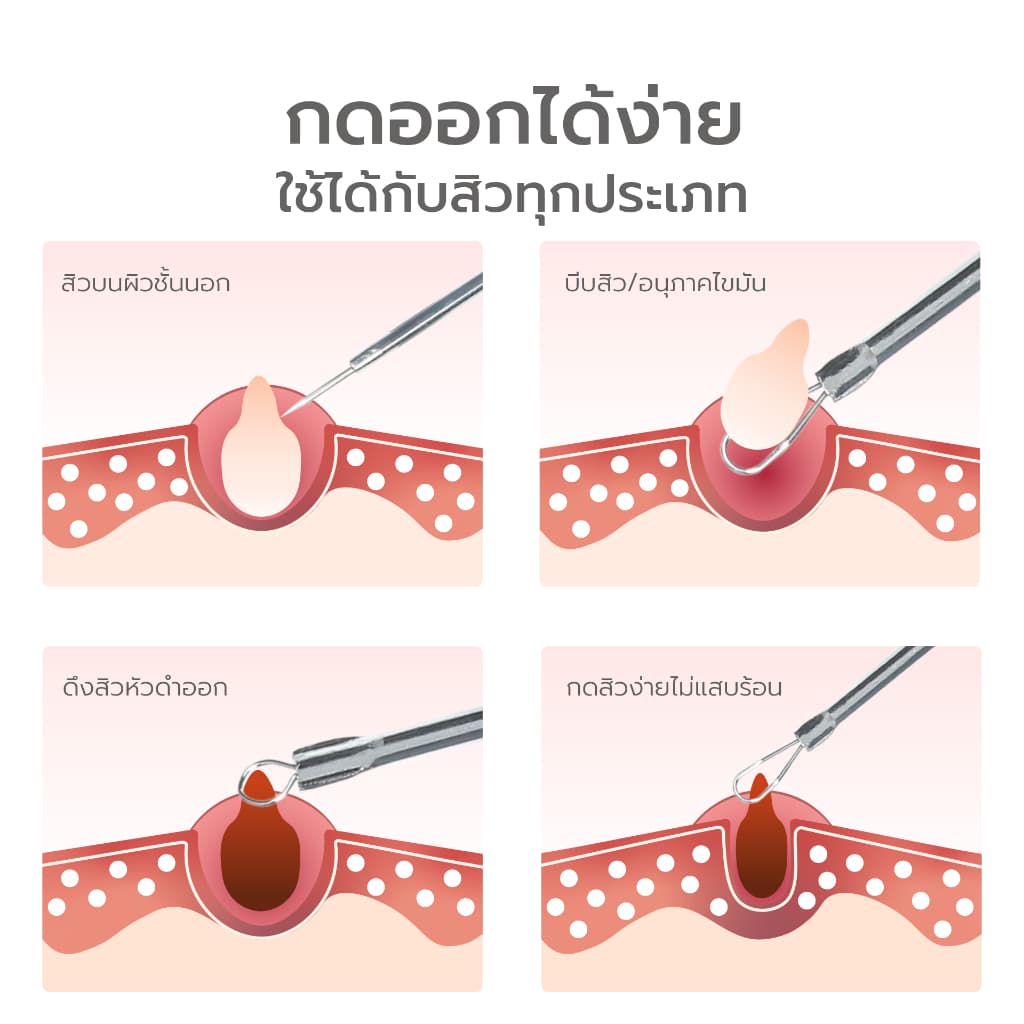 Simpskincare ชุดที่กดสิว อุปกรณ์กดสิว Acne tool 4ชิ้น 7ชิ้น สเตนเลสอย่างดี พกพาสะดวก พร้อมกล่อง รูปที่ 5