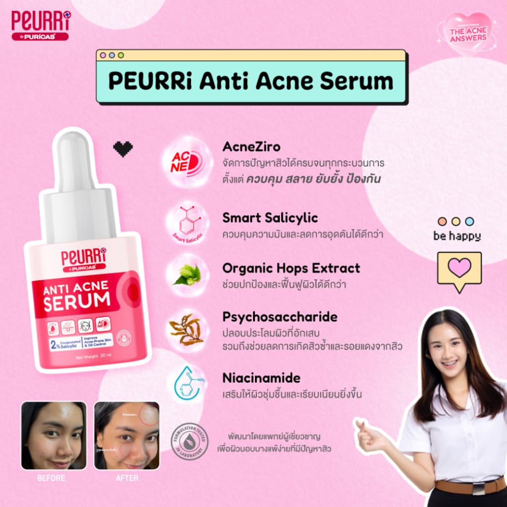 Anti Acne Serum 20ml. เซรั่มช่วยลดเลือนสิวอุดตัน รูปที่ 3