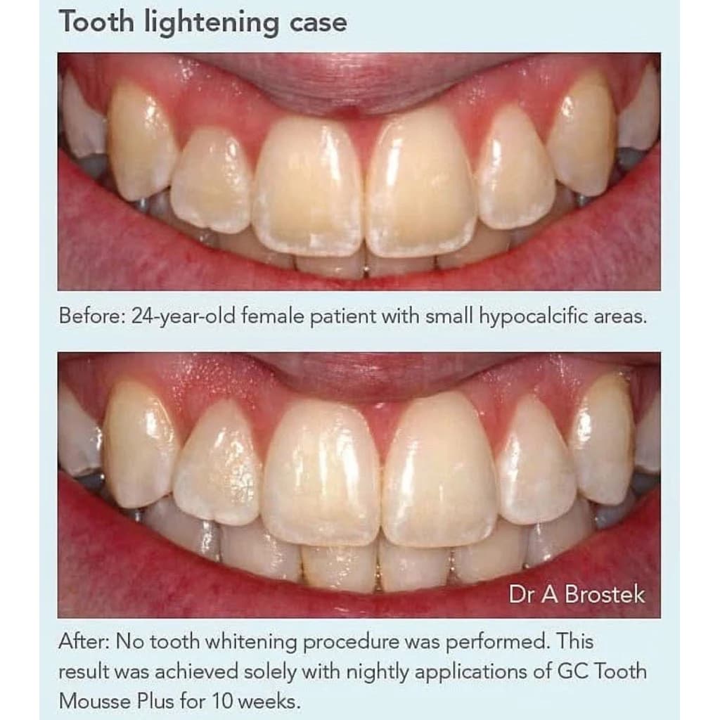 GC Tooth Mousse Plus Strawberry ผสมฟลูออไรด์ รูปที่ 6