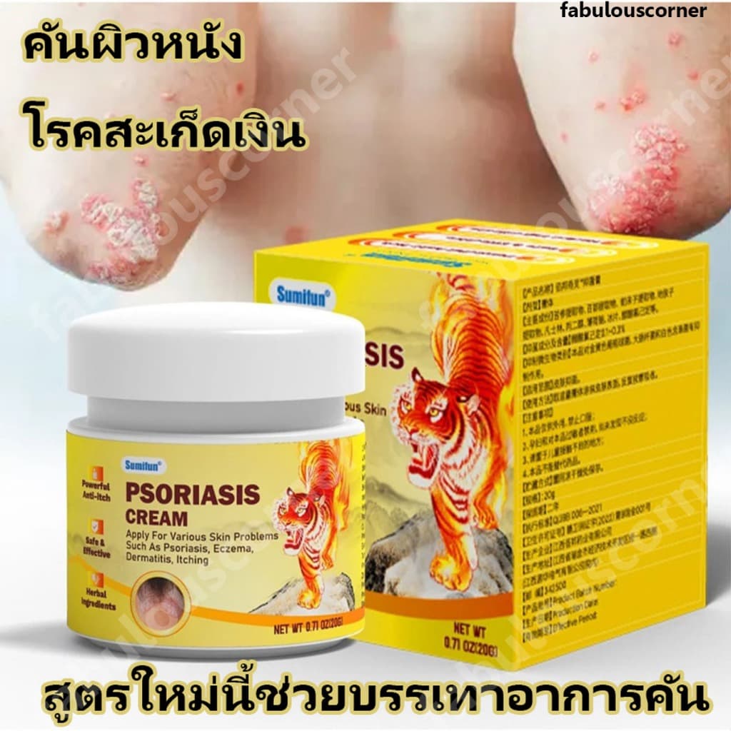 ครีมทาสังคัง สะเก็ดเงินครีม ครีมบำรุงผิว รอยแดง โรคผิวหนัง เกลื้อน กลาก คัน สมุนไพร แก้คันเรื้อรัง คันในร่มผ้า คันในร่มผ รูปที่ 1