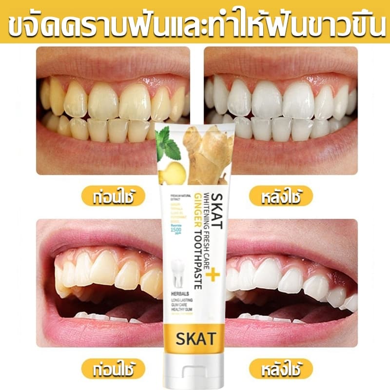 ยาสีฟันขิง ยาสีฟันสมุนไพรขิงขิง Skat ขนาด 50 กรัม ลดกลิ่นปาก ฟันขาว ฟันแข็งแรง ยาสีฟัน ยาสีฟันสูตรฟันขาว รูปที่ 3