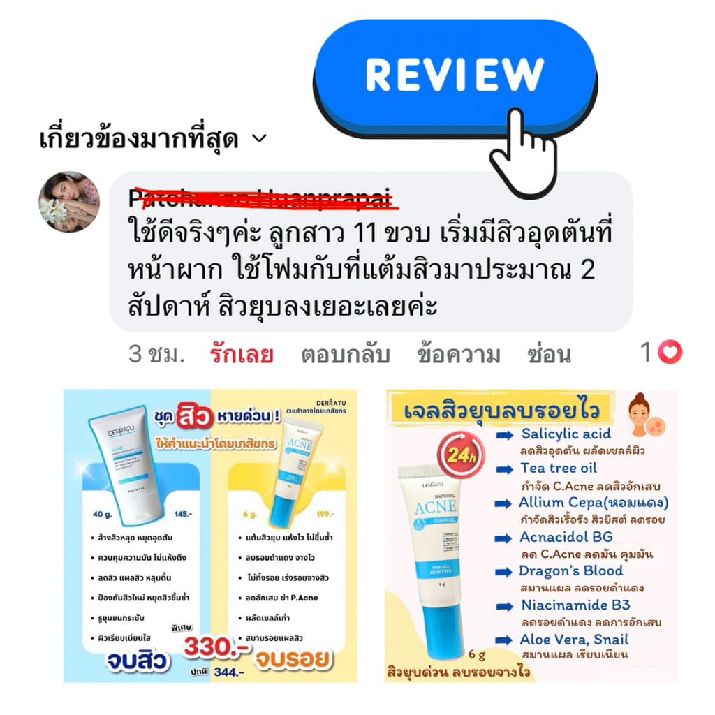 ชุดสิวหายด่วน DERRATU สิวอุดตัน สิวอักเสบ รอยดำสิว รูปที่ 5