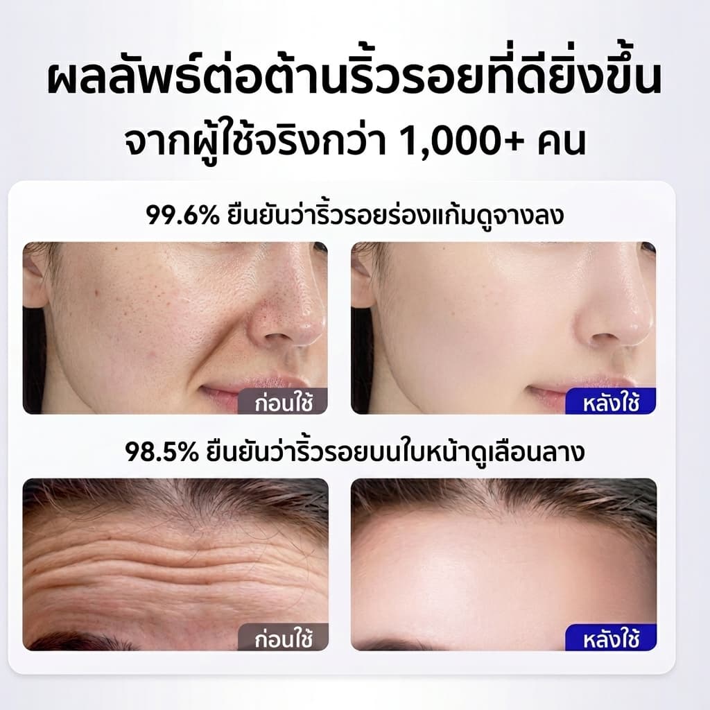 แผ่นแปะร่องแก้มลึก สติกเกอร์ยกกระชับริมฝีปาก เทปสติกเกอร์ ลดริ้วรอย กับเปปไทด์เข้มข้น ลดริ้วรอยบนใบหน้า ตา รูปที่ 3