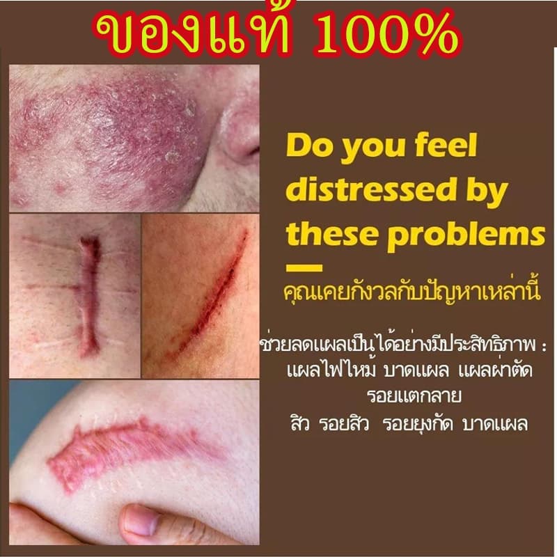 DERMATIX ULTRA GEL 15G. เจลป้องกันรอยแผลเป็น รูปที่ 5