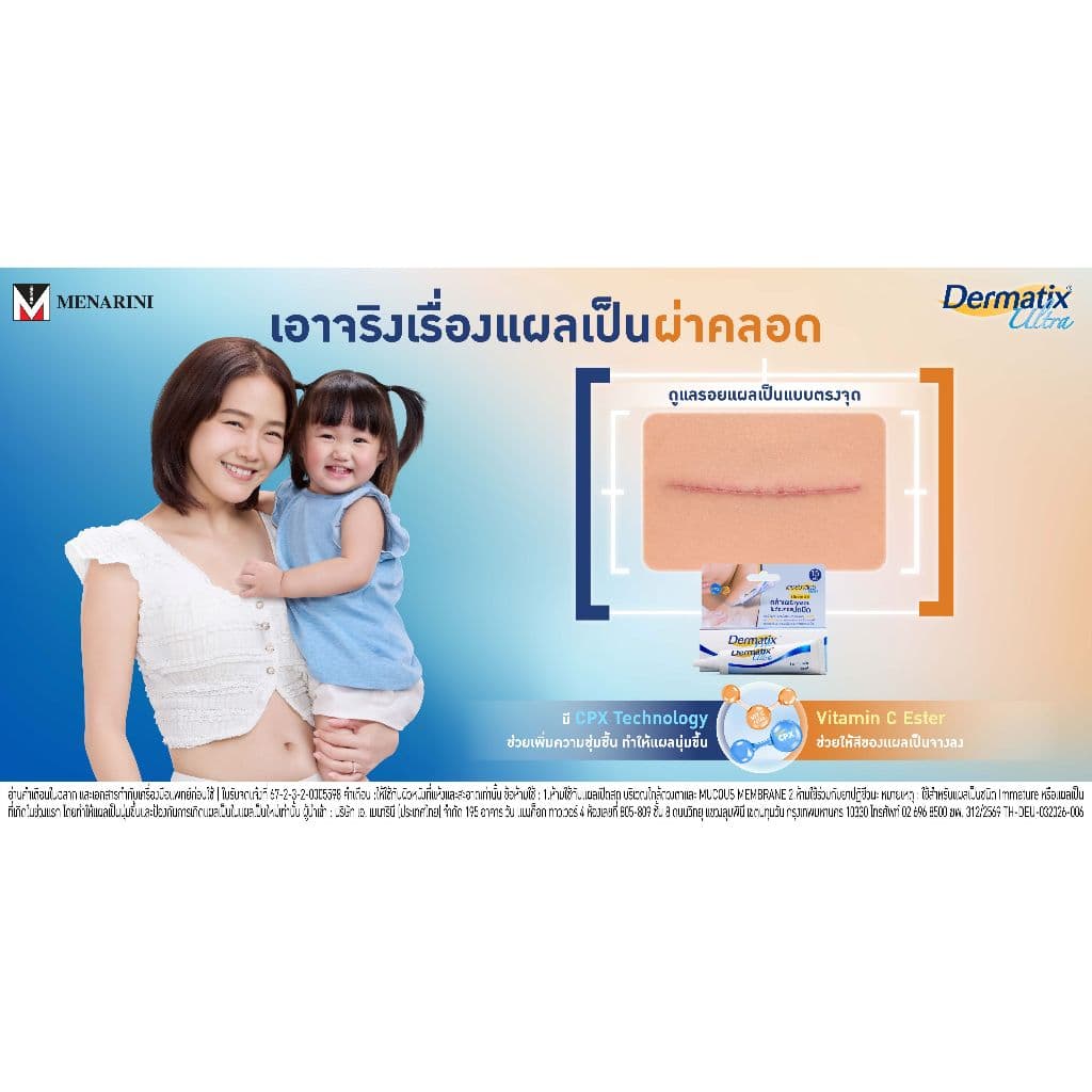 Dermatix Ultra Gel เดอร์มาติกซ์ อัลตร้า เจลลดรอยแผลเป็น ขนาด 15 กรัม รูปที่ 4