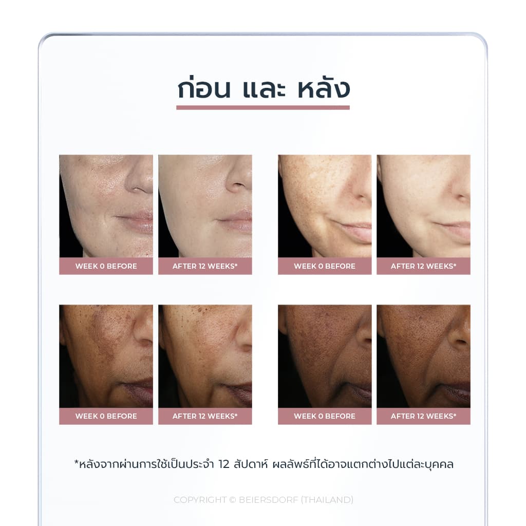ยูเซอริน สปอตเลส ไบรท์เทนนิ่ง สปอต คอร์เรคติ้ง 5 มล.EUCERIN SPOTLESS BRIGHTENING SPOT CORRECTING 5 ML. รูปที่ 6