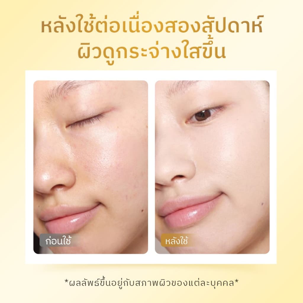 The Originote Hyalu-C Serum - เซรั่มไฮยา วิตซี ช่วยปรับผิวหน้าหมองคล้ำให้กระจ่างใส ให้สีผิวให้สม่ำเสมอ รูปที่ 3