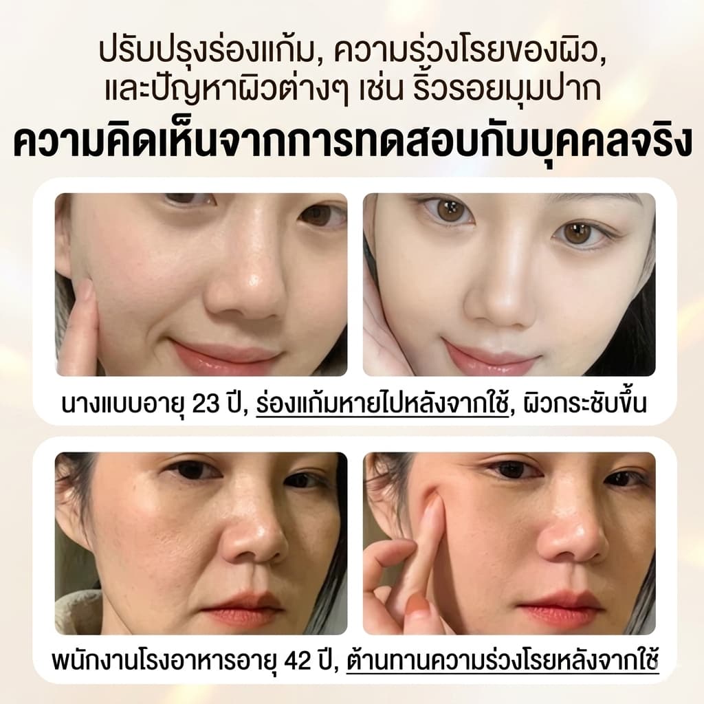 แผ่นแปะร่องแก้มลึก สติกเกอร์ยกกระชับริมฝีปาก เทปสติกเกอร์ ลดริ้วรอย กับเปปไทด์เข้มข้น ลดริ้วรอยบนใบหน้า ตา รูปที่ 4