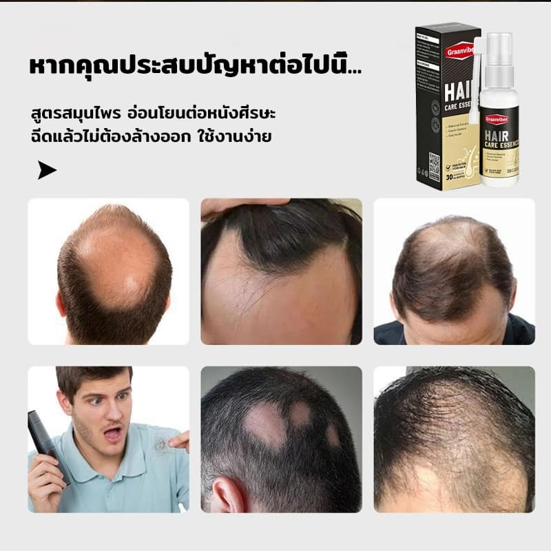 เซรั่มแก้ผมหงอก เซรั่มผมดำ เปลี่ยนผมขาวเป็นผมดกดำอย่างเป็นธรรมชาติ บำรุงรากผม สูตรเข้มข้น รูปที่ 4