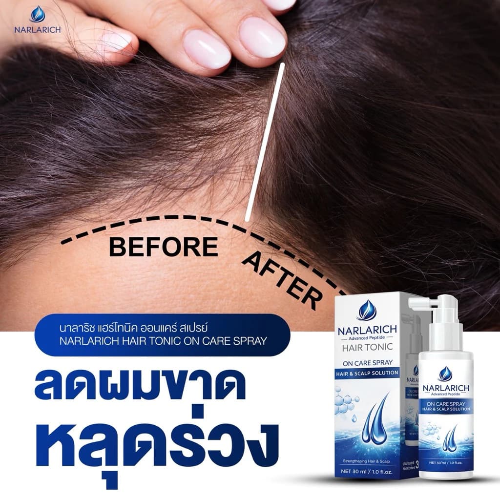 NARLARICH HAIR TONIC ON CARE นาลาริช แฮร์ไทนิค ออนแคร์ แฮร์ เซรั่มผม ลดผมมัน ผมร่วง ดกดำ Carine รูปที่ 6