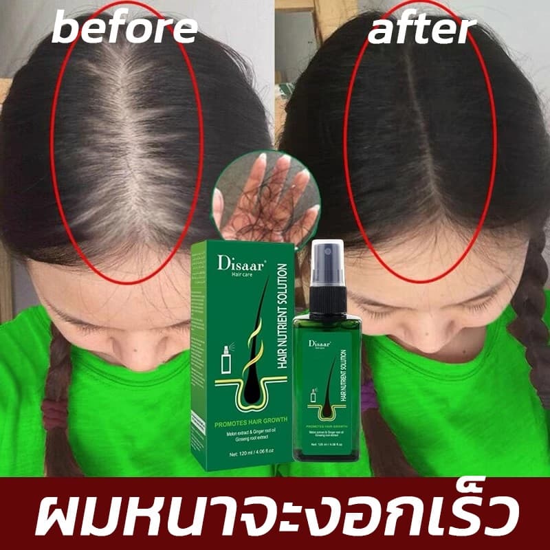 รับประกันของแท้ Disaar นีโอแฮร์ของแท้ 120ML สเปรย์ปลูกผม ผมบาง สเปรย์เซรั่มปิดผมบาง  เก็บเงินปลายทาง น้ำยาปล เซรั่มลดผมร