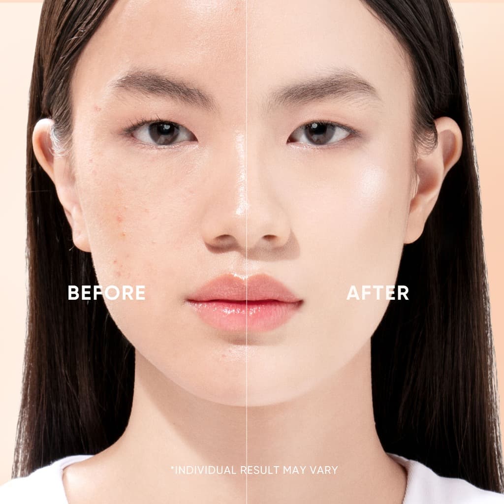 SKINTIFIC Retinol Skin Renewal Moisturizer เรตินอล สคิน รีนิวเวิล มอยเจอร์ไรเซอร์ ครีม ลดเลือนริ้วรอยใน 2 สัปดาห์ รูปที่ 6