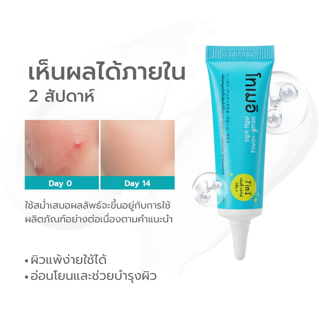 Simple Beauty เจลแต้มสิว ยาแต้มสิว Tomei Anti-acne Cream Plus ลดรอยสิว ยุบไว รูปที่ 4