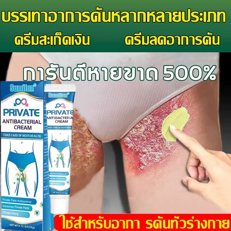 ครีมแก้คันครีมบรรเทาอาการคันบริเวณจุดซ่อนเร้นสำหรับผู้ชาย บรรเทาอาการคันบริเวณขาหนีบ ต้นขาด้านใน และบริเวณที่บอบบางอื่นๆ