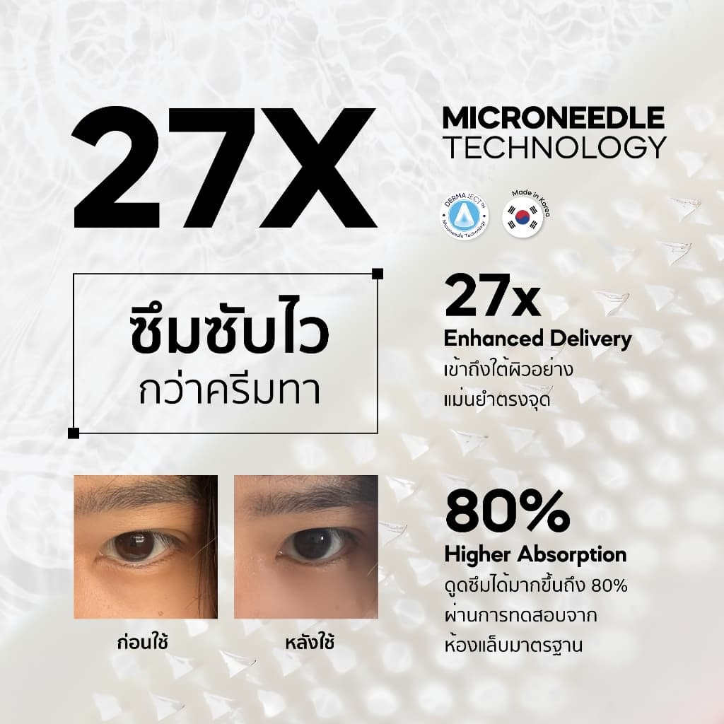 The Awesome Patch – กู้รอยคล้ำใต้ตาแบบเร่งด่วน มาร์กเข็มลดริ้วรอย ไมโครนีดเดิล 1,800 เข็ม | By Moonshot Labs รูปที่ 3