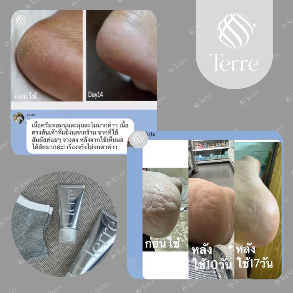 Terre Ultra Repair Cream เทอร์เร่อัลตรารีแพร์ครีม สูตรเข้มข้น สำหรับเท้า มือ ศอก เข่า 120 มล. รูปที่ 5