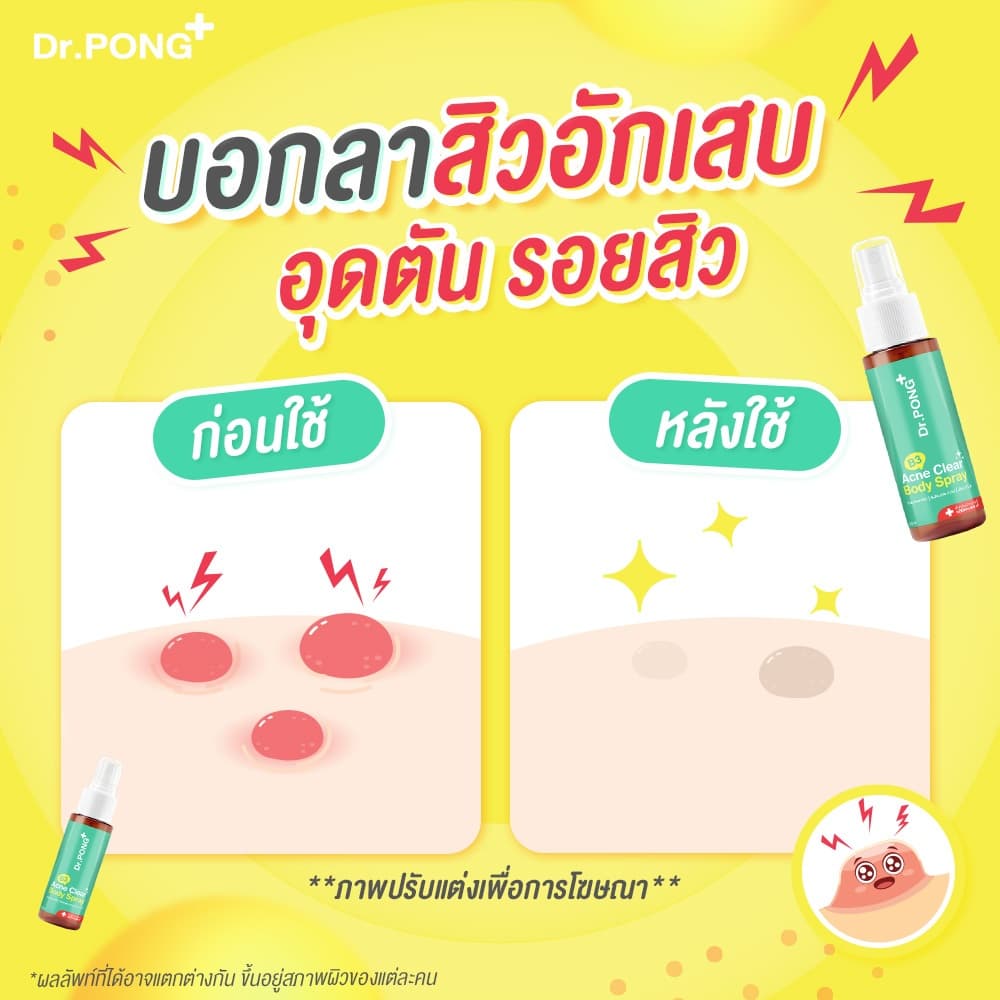 Dr.PONG B3 Acne Clear Body Spray สเปรย์ฉีดที่หลัง และลำตัว Niacinamide - BHA - ZincPCA รูปที่ 4