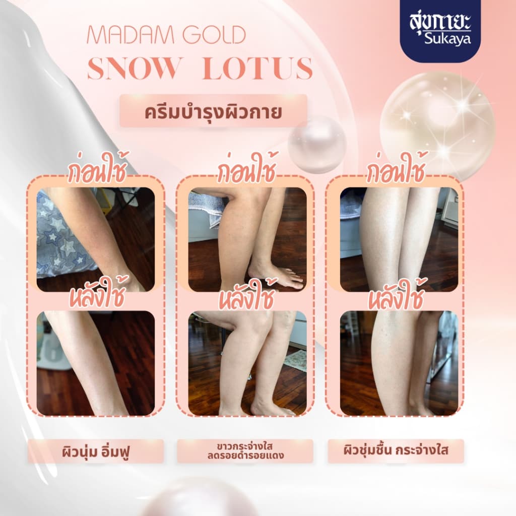 Madam Gold ครีมทาตัวบัวหิมะพีโอนี ขนาด 250 ml จบปัญหาผิวแห้งกร้าน ขาลาย ขนคุด ผิวสวย รูปที่ 8