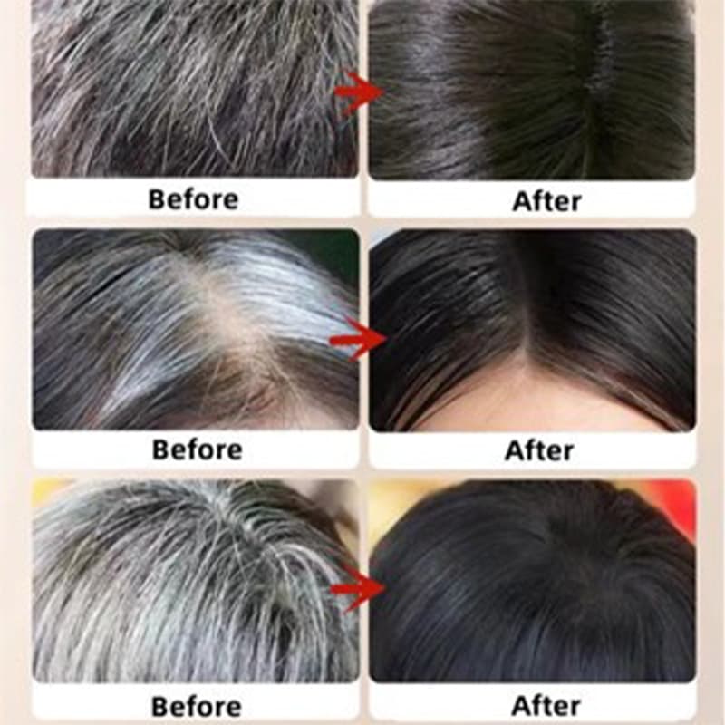 แชมพูโสมสกัดจากพืชธรรมชาติ safemild ช่วยบำรุงเส้นผมอย่างอ่อนโยนและปรับปรุงผมหงอกและผมร่วง รูปที่ 3