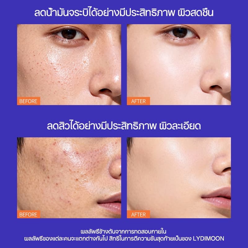 เมน โฟมล้างหน้า เจลล้างหน้าสำหรับผู้ชายโดยเฉพาะ 100g ลดสิว ควบคุมความมัน ทำความสะอาดรูขุมขน ผิวสะอาดสดชื่น รูปที่ 3