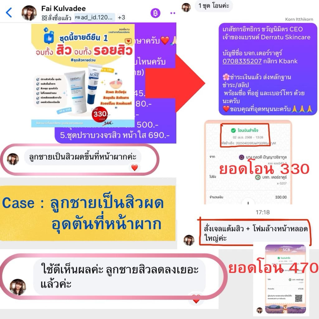 ชุดสิวหายด่วน DERRATU สิวอุดตัน สิวอักเสบ รอยดำสิว รูปที่ 7