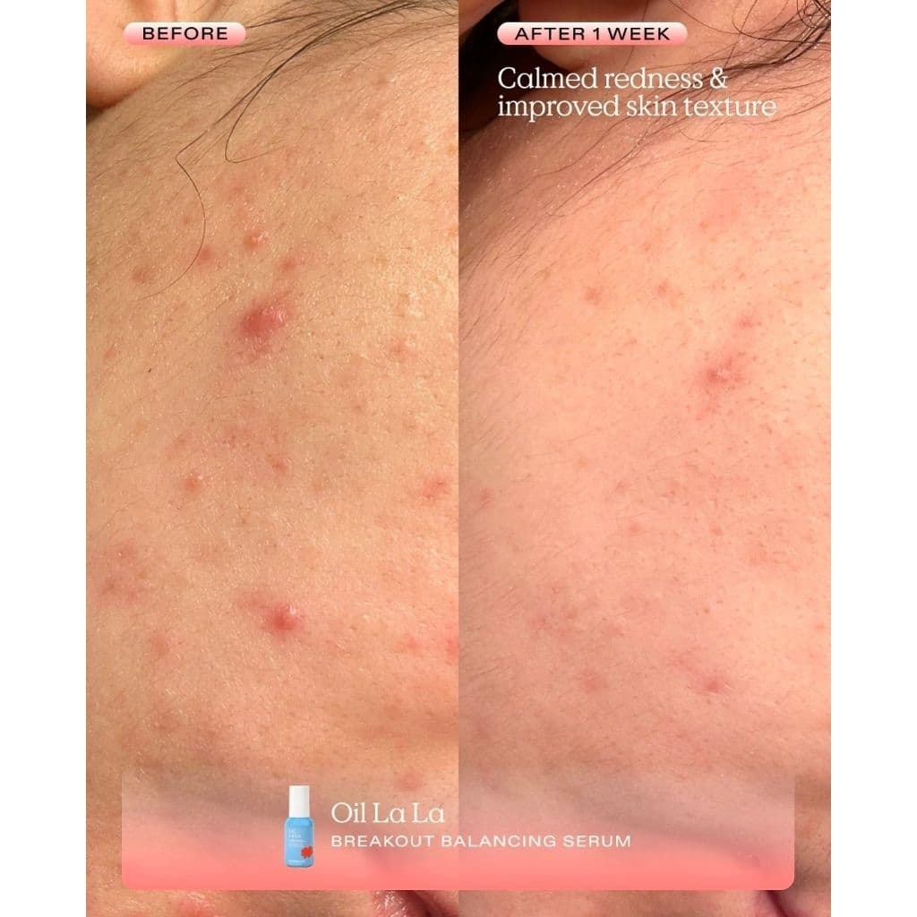 Krave beauty oil la la 45ml รูปที่ 4